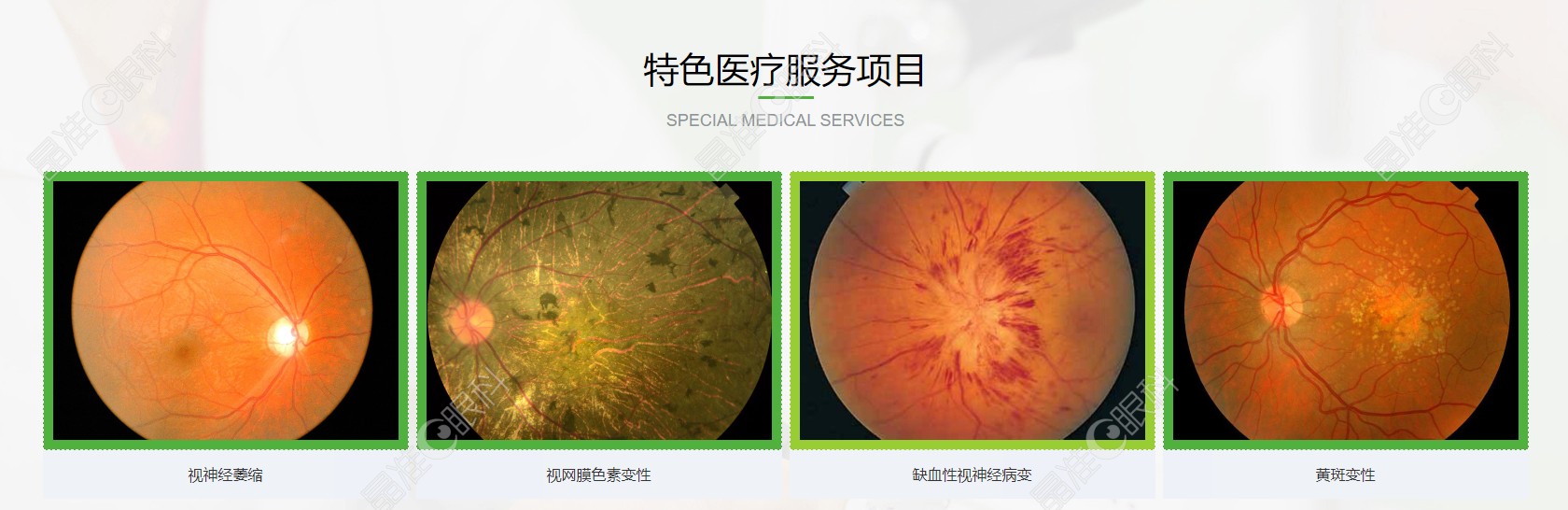 长春恒达眼科医院的特色项目