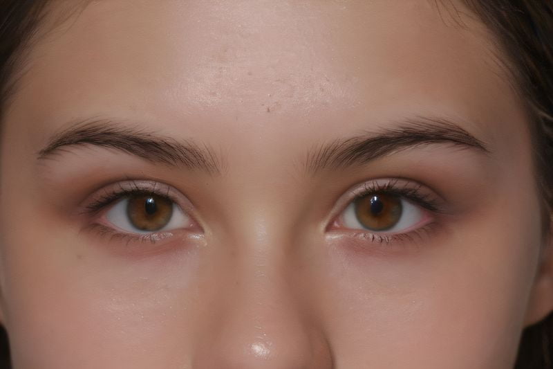 美国眼力健（Abbott Medical Optics, AMO）