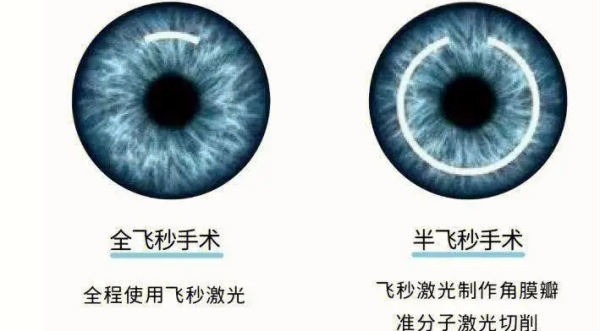 长沙博视眼科医院价格