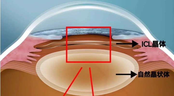 包头朝聚眼科医院医生团队概况
