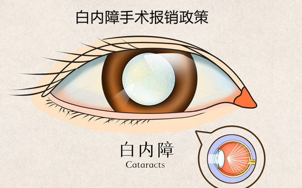 申请包头白内障手术免费政策需要满足什么条件？