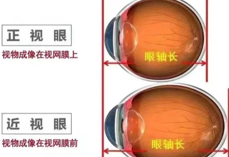 四、如何选择适合自己的眼科医院