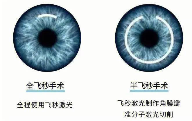 四、武汉阿玛施眼科预约挂号本地高频问题解答