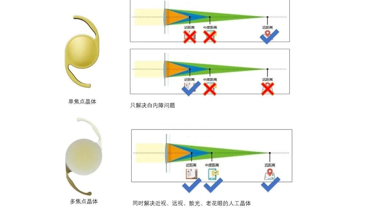 二、成都爱迪眼科医院是私立医院吗？从医院类型看属于专科眼科医院