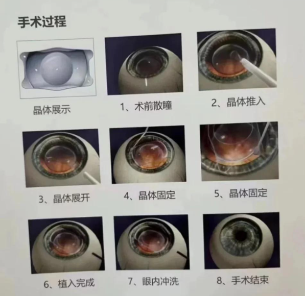 三、驻马店尖峰眼科医院是正规医院吗？医生和设备也是判断重点www.ji-zhun.com