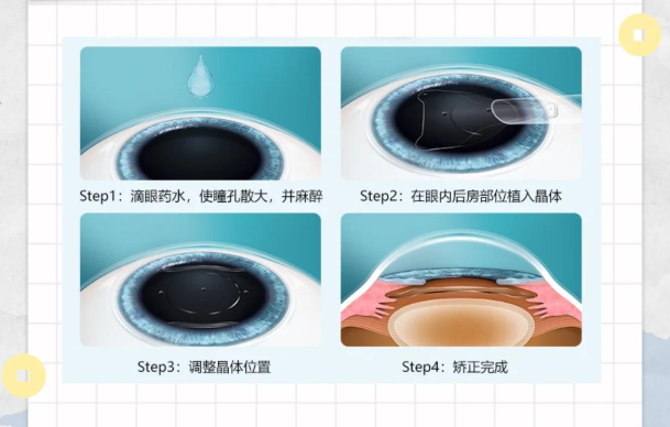 二、驻马店尖峰眼科医院是正规医院吗？它其实是连锁眼科体系